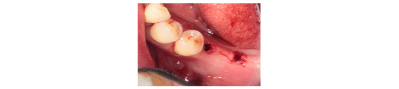 http://static.apub.kr/journalsite/sites/kaomi/2017-021-04/N0880210403/images/Figure_KAOMI_21_04_03_F27.jpg